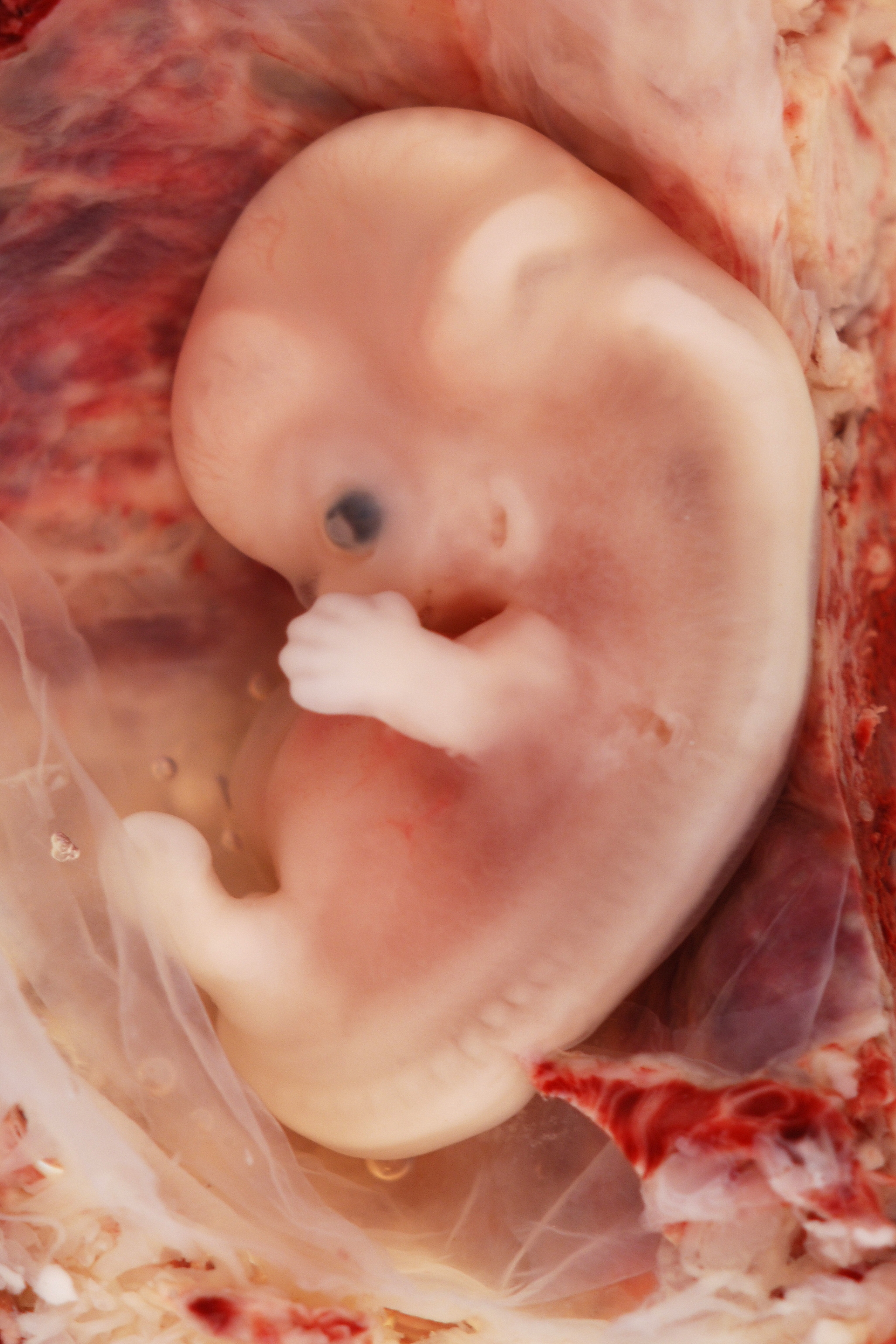 Menschlicher Embryo